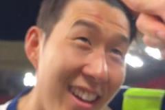 孙兴慜奖杯事故：捧杯时被推蹭伤额头